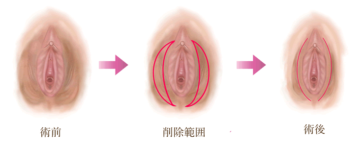 仕上がりイメージ