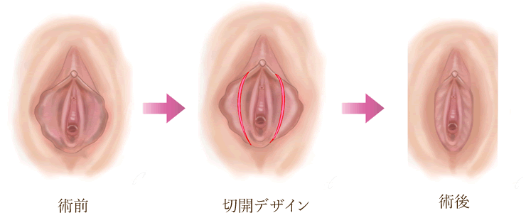 仕上がりイメージ